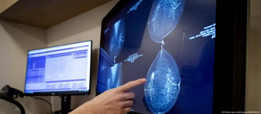 Mô hình AI mới dự đoán nguy cơ ung thư trong 5 năm